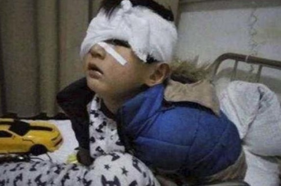 Dù tức giận đến mấy bố mẹ cũng không nên đánh vào 3 vùng nhạy cảm này của trẻ, kẻo có thể gây bại não, để lại di chứng sau này!-3