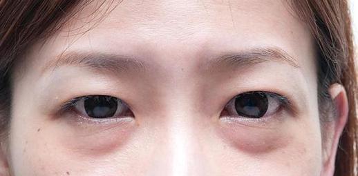 Người tuổi thọ ngắn sẽ có 4 biểu hiện vào buổi sáng, nếu bạn có 2 biểu hiện thôi thì sức khỏe đã rất đáng lo-4