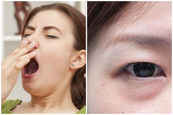 Ai cũng sợ mỡ thừa, nhưng phụ nữ nhiều mỡ ở 3 bộ phận này càng chứng tỏ khỏe mạnh, sống thọ: Kiểm tra xem bạn có không?-4