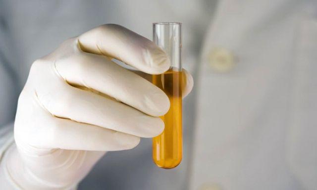 Ngủ dậy có 1 trong 4 triệu chứng này chứng tỏ gan không tốt, để lâu dễ thành ung thư-1
