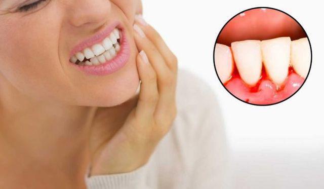 Ngủ dậy có 1 trong 4 triệu chứng này chứng tỏ gan không tốt, để lâu dễ thành ung thư-2