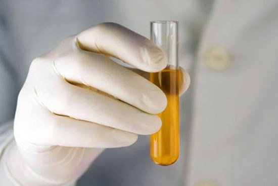 Ngủ dậy có 1 trong 4 triệu chứng này chứng tỏ gan không tốt, để lâu dễ thành ung thư