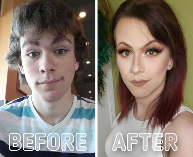 Loạt ảnh trước - sau của những ca phẫu thuật chuyển giới thành công mĩ mãn chứng tỏ khi được là chính mình bạn mới tỏa sáng rực rỡ nhất-11