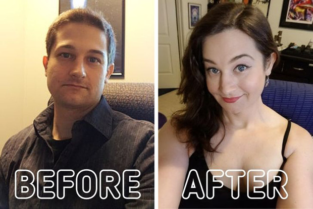 Loạt ảnh trước - sau của những ca phẫu thuật chuyển giới thành công mĩ mãn chứng tỏ khi được là chính mình bạn mới tỏa sáng rực rỡ nhất-12