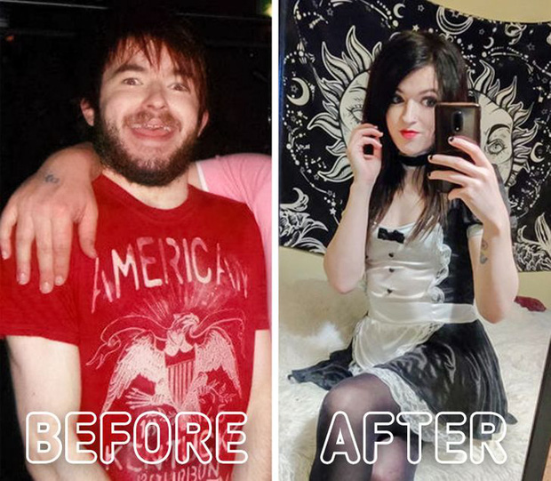 Loạt ảnh trước - sau của những ca phẫu thuật chuyển giới thành công mĩ mãn chứng tỏ khi được là chính mình bạn mới tỏa sáng rực rỡ nhất-15