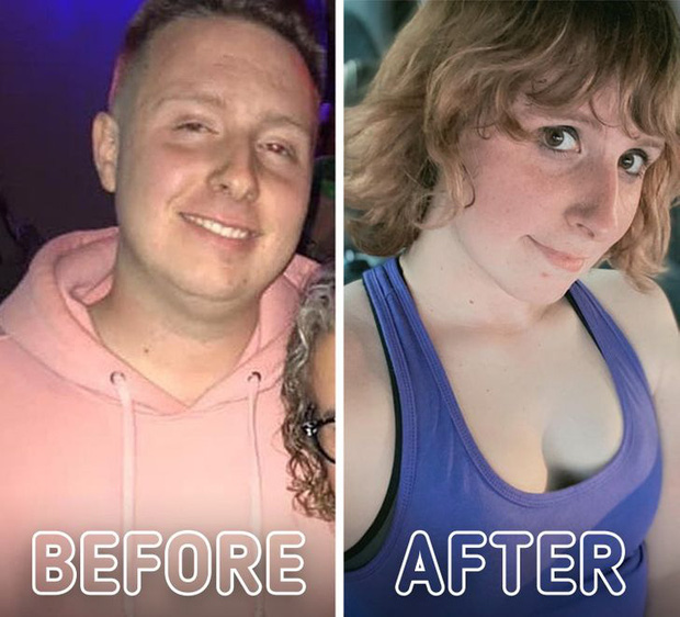 Loạt ảnh trước - sau của những ca phẫu thuật chuyển giới thành công mĩ mãn chứng tỏ khi được là chính mình bạn mới tỏa sáng rực rỡ nhất-20