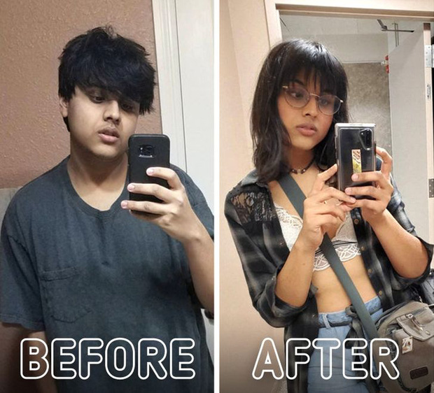 Loạt ảnh trước - sau của những ca phẫu thuật chuyển giới thành công mĩ mãn chứng tỏ khi được là chính mình bạn mới tỏa sáng rực rỡ nhất-5