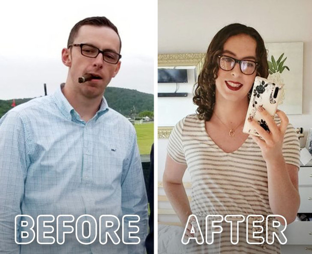 Loạt ảnh trước - sau của những ca phẫu thuật chuyển giới thành công mĩ mãn chứng tỏ khi được là chính mình bạn mới tỏa sáng rực rỡ nhất-9