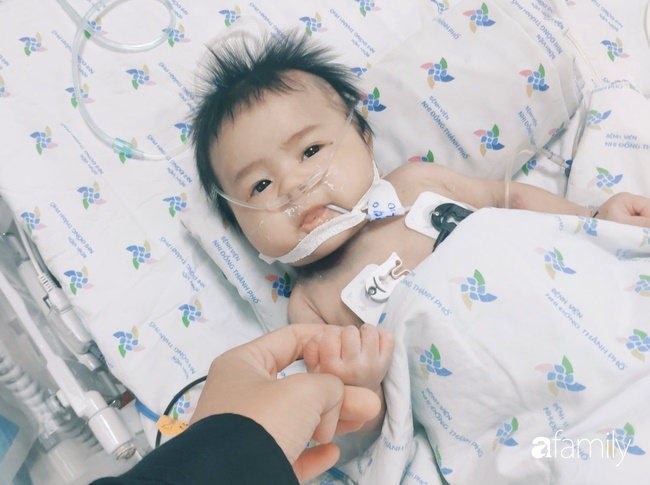 Bé trai 2 tháng tuổi suy hô hấp, nguy kịch do mẹ liên tục ăn củ dền trong thai kì và sau sinh-1