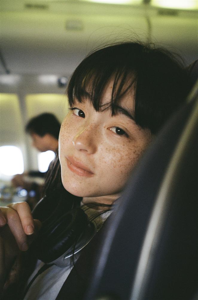 Khi thiếu hụt vitamin E quá nhiều, phụ nữ sẽ có 5 triệu chứng rất dễ nhầm lẫn: Nếu bỏ qua, bạn sẽ nhanh già và thêm ốm yếu-1