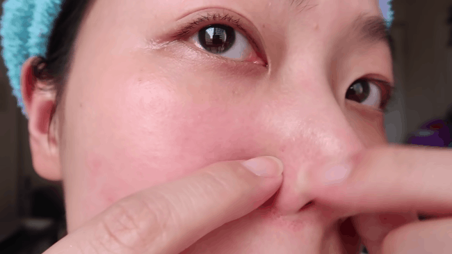 Beauty blogger người Nhật dạy cách trị mụn đầu đen ngay từ bước rửa mặt, nhấn mạnh việc nặn hay lột mụn sẽ khiến da lão hóa cực nhanh-8
