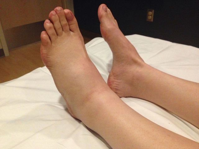 Có 3 biểu hiện của cơ thể vào ban đêm, chứng tỏ thận của bạn đang rất khỏe mạnh-2