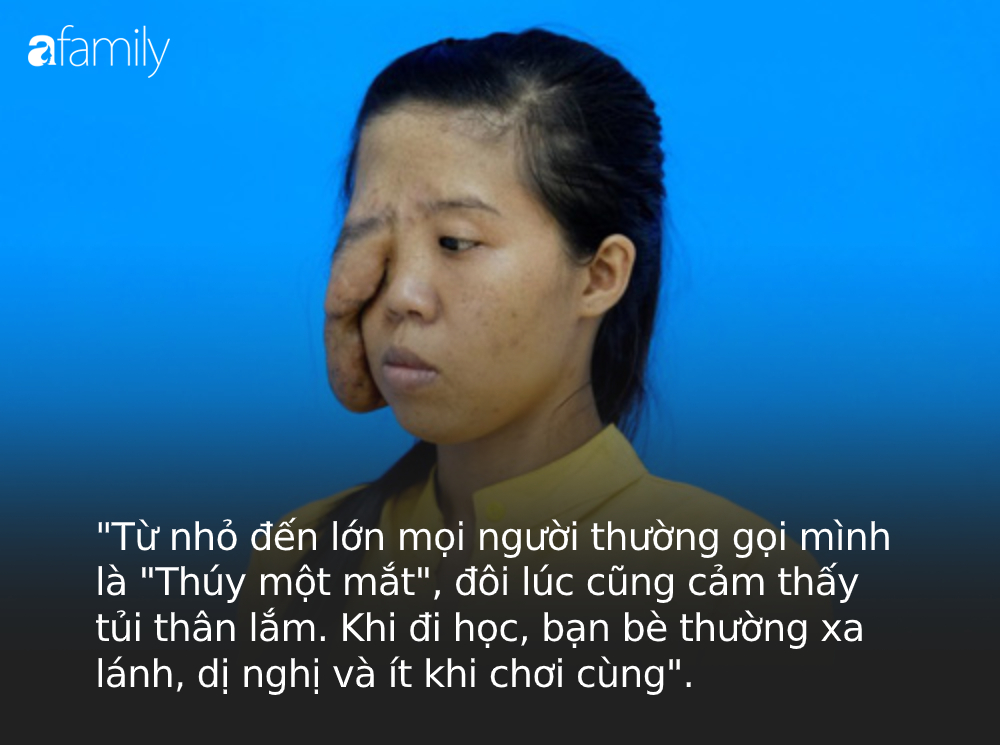 27 năm mặc cảm vì bị gọi là một mắt”, chồng bỏ đi khi con mới 1 tuổi, mẹ đơn thân khát khao đổi đời nhờ PTTM và cuộc lột xác khiến không ít người mong chờ-3