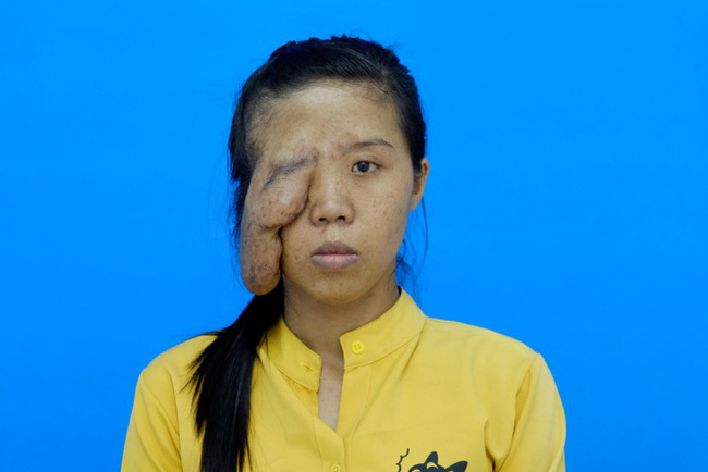 27 năm mặc cảm vì bị gọi là một mắt”, chồng bỏ đi khi con mới 1 tuổi, mẹ đơn thân khát khao đổi đời nhờ PTTM và cuộc lột xác khiến không ít người mong chờ-4