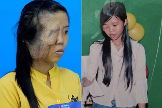 27 năm mặc cảm vì bị gọi là “một mắt”, chồng bỏ đi khi con mới 1 tuổi, mẹ đơn thân khát khao đổi đời nhờ PTTM và cuộc lột xác khiến không ít người mong chờ