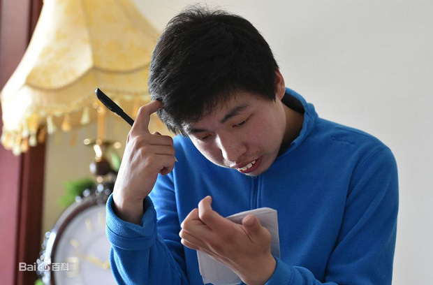 Đứa trẻ bại não bị trường đuổi học vì khờ khạo nhưng có tài tính nhầm siêu phàm, sau đó trở thành Siêu trí tuệ khiến ai cũng nể phục-1