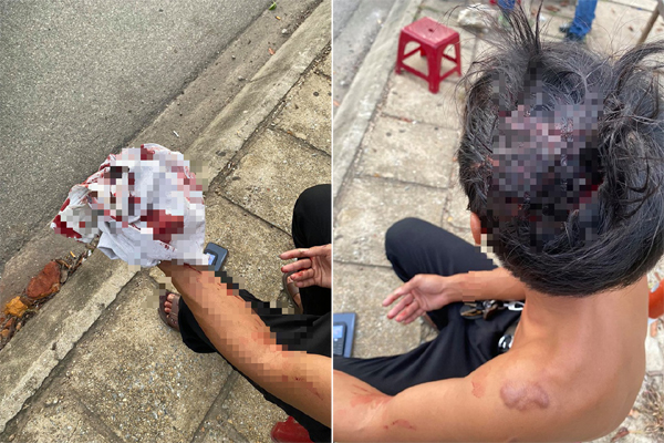 Clip người đàn ông tung cú đấm trời giáng vào mặt khiến nữ công nhân ngất xỉu gây phẫn nộ-2