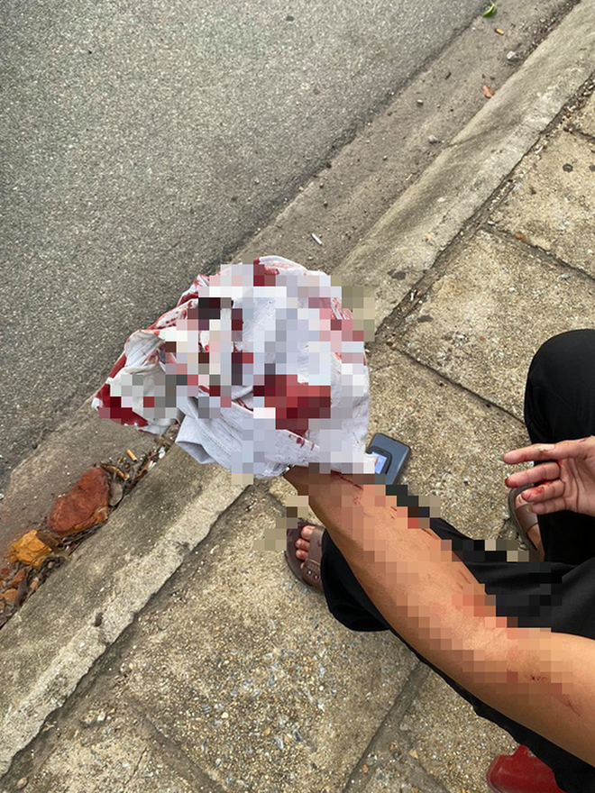 Clip: Tranh giành khách tại sân bay, 2 nhóm tài xế taxi đuổi đánh nhau bể đầu-1