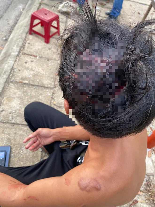 Clip: Tranh giành khách tại sân bay, 2 nhóm tài xế taxi đuổi đánh nhau bể đầu-2