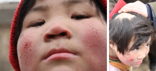 Ngành chăn dắt trẻ ăn xin ở Châu Á: Kẻ máu lạnh tạo ra những đứa bé khuyết tật và biến chúng thành cỗ máy kiếm tiền vô đạo đức-5