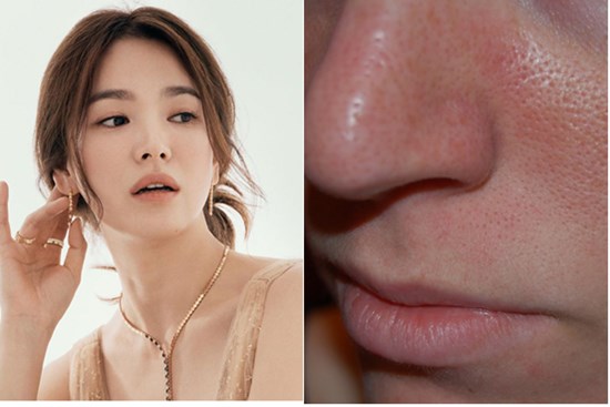 5 sao Hàn tuổi ngoài 30 có cách riêng để thu nhỏ lỗ chân lông cho làn da lão hóa: Không tốn một đồng mà vẫn hiệu quả tức thì