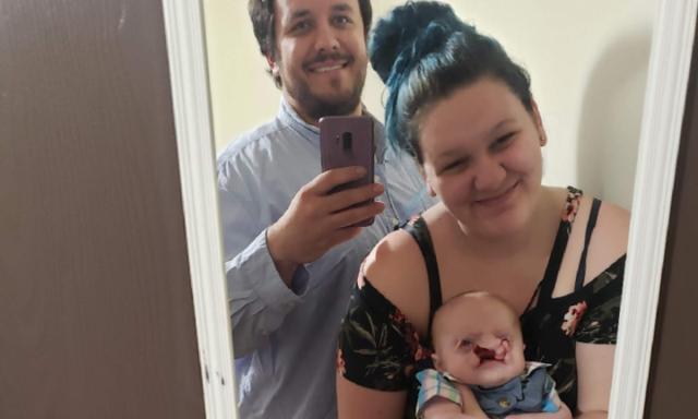 Sao cô không phá thai đi”: Câu chuyện đau lòng của một bà mẹ có con bị tật hở hàm ếch-1