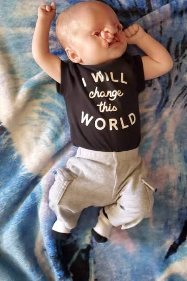 Sao cô không phá thai đi”: Câu chuyện đau lòng của một bà mẹ có con bị tật hở hàm ếch-2