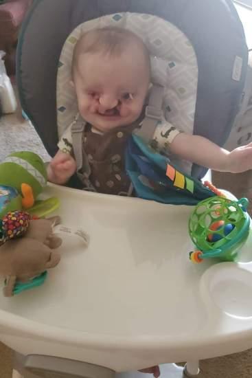 Sao cô không phá thai đi”: Câu chuyện đau lòng của một bà mẹ có con bị tật hở hàm ếch-4