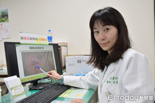 Chủ quan với vết ban đỏ trên trán, người phụ nữ không ngờ đó là dấu hiệu bệnh ung thư-3