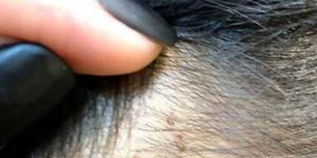 Hàng loạt học sinh mẫu giáo có vết kim đâm kỳ lạ trên cơ thể, lời kể của những đứa bé khiến ai cũng phải xót xa-2