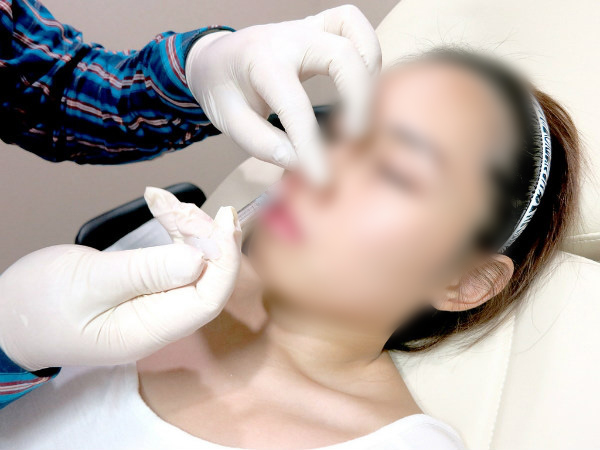 Nữ nhân viên ngân hàng 27 tuổi suýt mù vì tiêm filler nâng mũi ở spa tư nhân-1