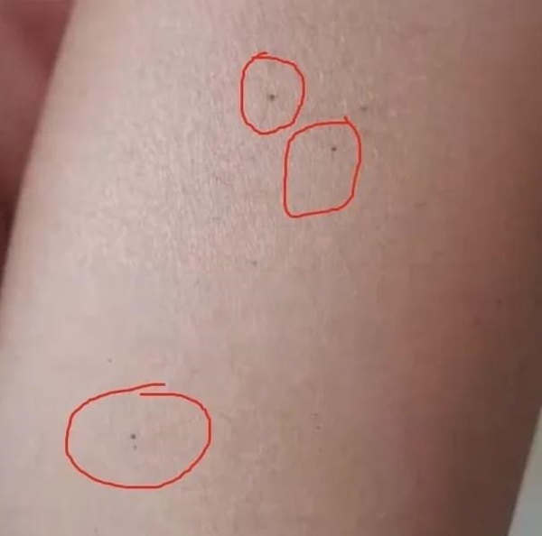 Vụ trẻ mẫu giáo có vết kim đâm kỳ lạ: Cảnh sát bắt được 3 cô giáo tàn độc, hiệu trưởng trường mẫu giáo bị cách chức-3