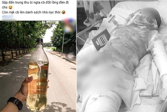 Thương tâm: Thiếu nữ bị bỏng đến 95%, nghi do bạn trai tưới xăng đốt tại vườn cao su ở Bình Dương