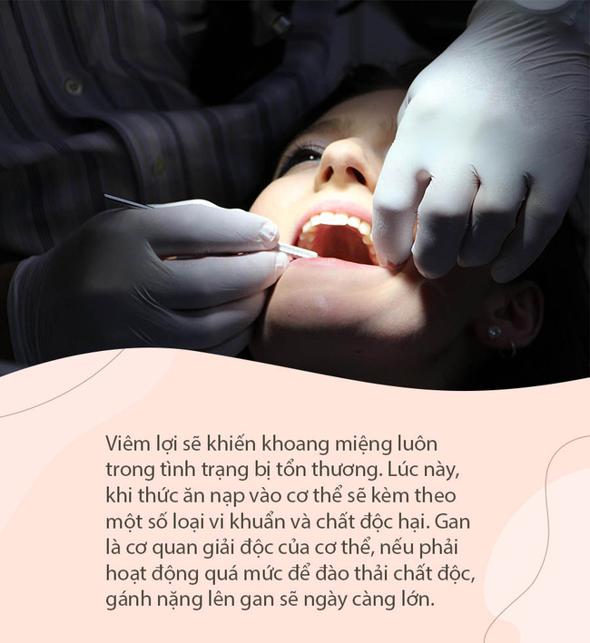 Đừng nghĩ viêm lợi là vấn đề nhẹ vì nó tiềm ẩn nhiều hiểm họa, đặc biệt có thể gây ra 3 loại ung thư-1