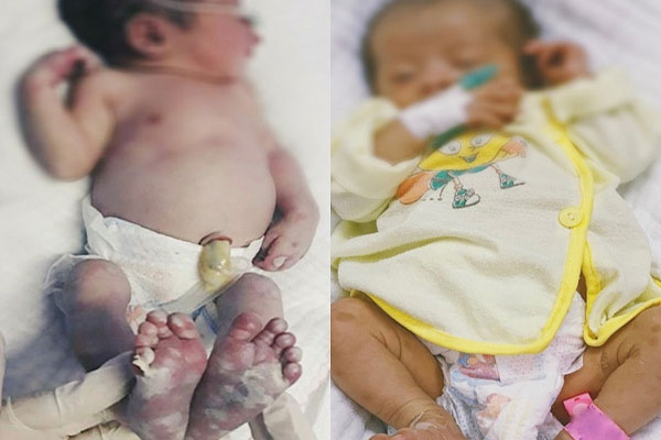 Người đàn ông ở Đồng Nai bị giang mai ở bộ phận hiếm gặp-2