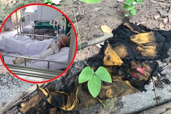 Vụ thiếu nữ 15 tuổi tử vong vì bị bạn trai tẩm xăng đốt: Chị gái khóc hết nước mắt, cố nén nỗi đau để lo hậu sự cho em