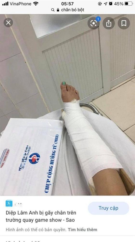 Nghe nhân viên kể khổ bị tai nạn gãy chân, cô gái có màn bóc mẽ nhẹ nhàng chỉ nhờ 1 tấm ảnh lại khiến ai nấy cười lăn lộn-2