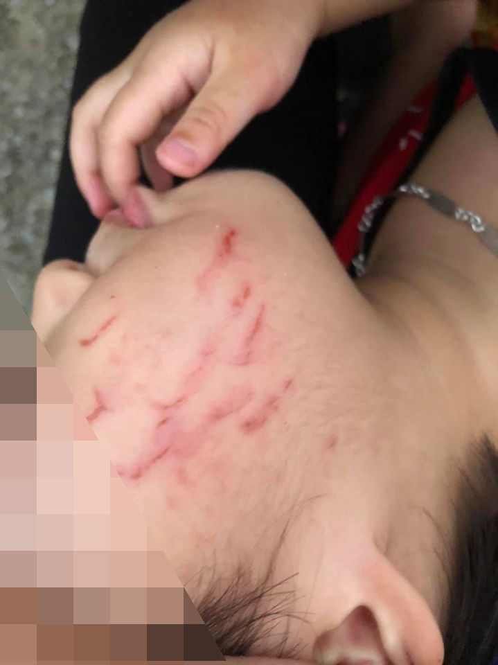 Năm học mới bắt đầu chưa đầy 1 tháng mà nhiều phụ huynh đã khóc cạn nước mắt: Con đi học hết bị bạn đánh đến bố bạn hành hung-2