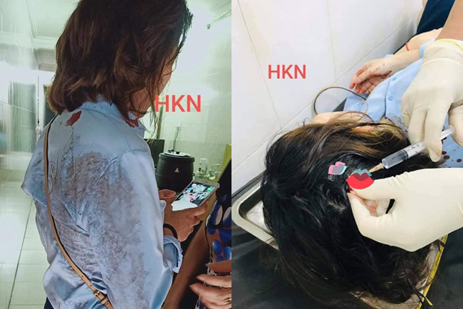 Xót xa tâm thư của bé gái Hải Phòng nghi bị bố ruột bạo hành bằng dây điện quấn băng dính: Mong lớn nhanh để tự do về với mẹ-2