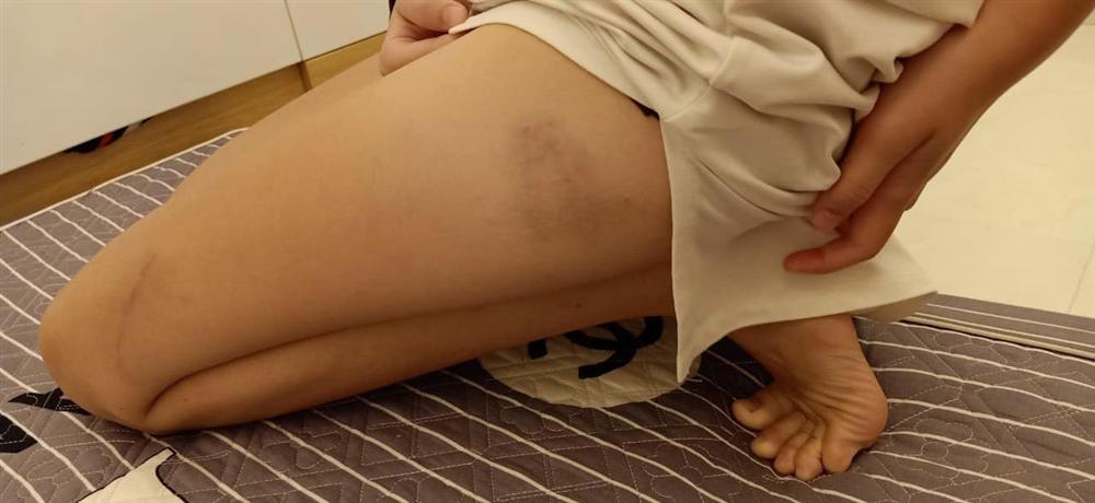 Xót xa tâm thư của bé gái Hải Phòng nghi bị bố ruột bạo hành bằng dây điện quấn băng dính: Mong lớn nhanh để tự do về với mẹ-3