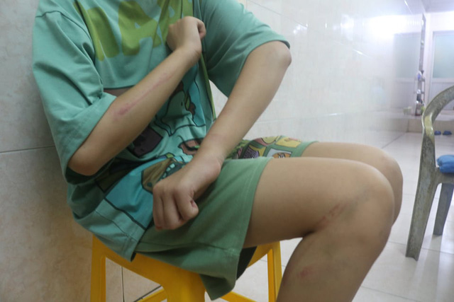 Xót xa tâm thư của bé gái Hải Phòng nghi bị bố ruột bạo hành bằng dây điện quấn băng dính: Mong lớn nhanh để tự do về với mẹ-4