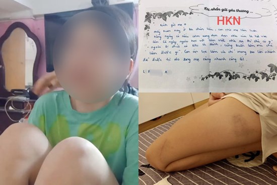 Xót xa tâm thư của bé gái Hải Phòng nghi bị bố ruột bạo hành bằng dây điện quấn băng dính: Mong lớn nhanh để tự do về với mẹ