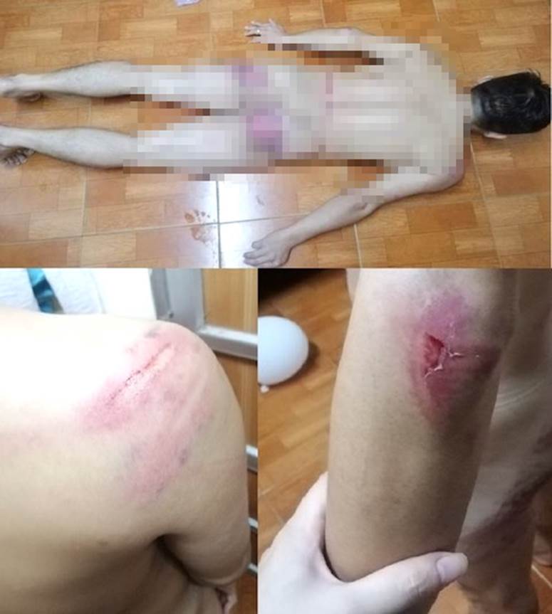 Vay nặng lãi, con nợ bị côn đồ đưa về trụ sở công ty rồi đánh đập dã man-3