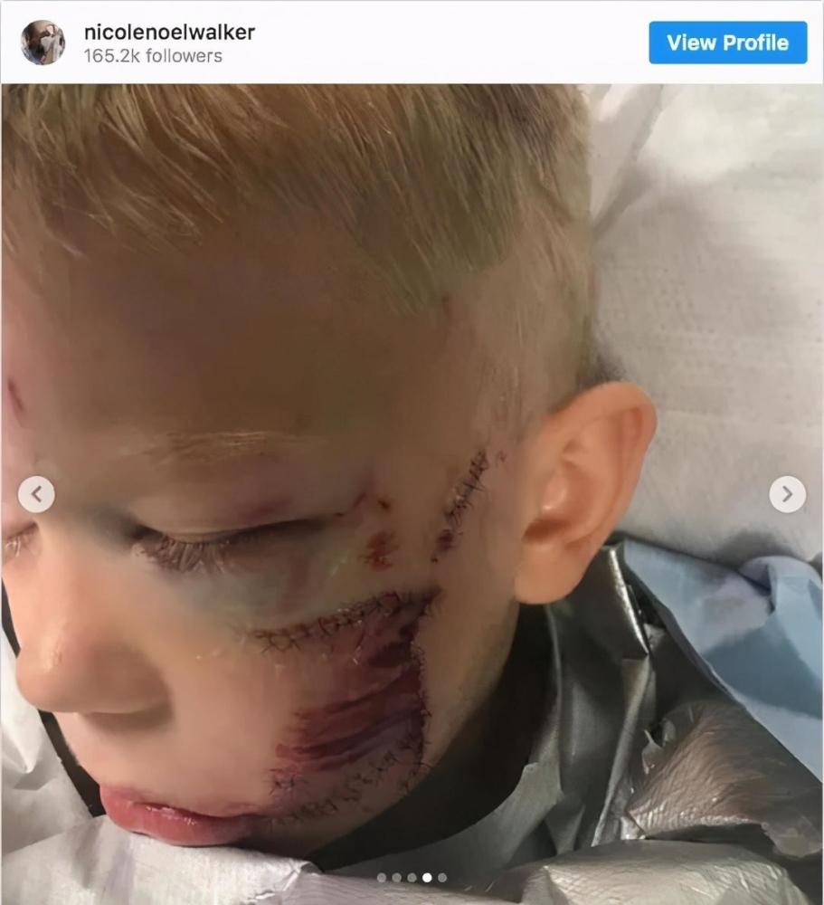 Em gái 3 tuổi chạy 2 tiếng mỗi ngày để cứu anh trai: Yêu anh trai là bản năng của em gái-3