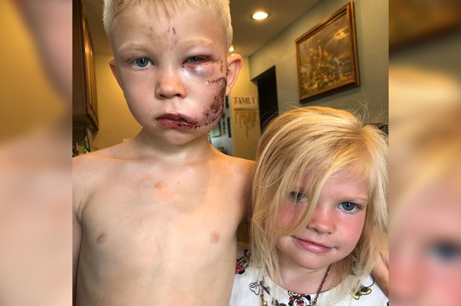 Em gái 3 tuổi chạy 2 tiếng mỗi ngày để cứu anh trai: Yêu anh trai là bản năng của em gái-4