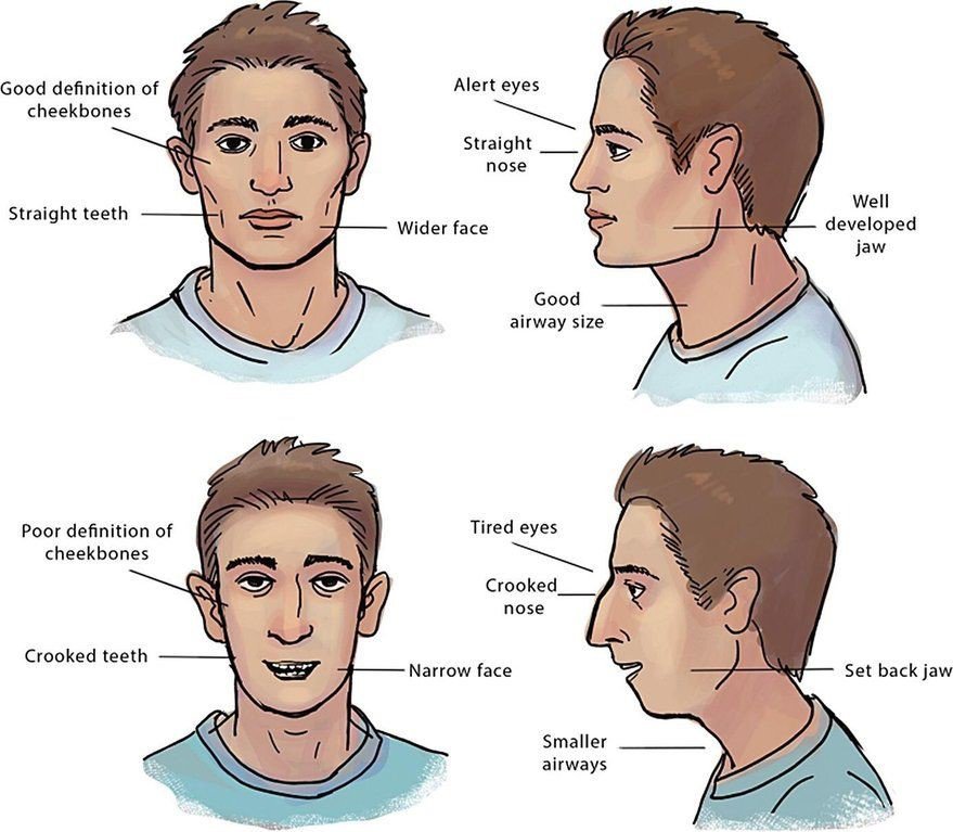 Càng lớn con càng xấu, ông bố nghi ngờ đưa con đi xét nghiệm, ngẩn ngơ nhận kết quả-3