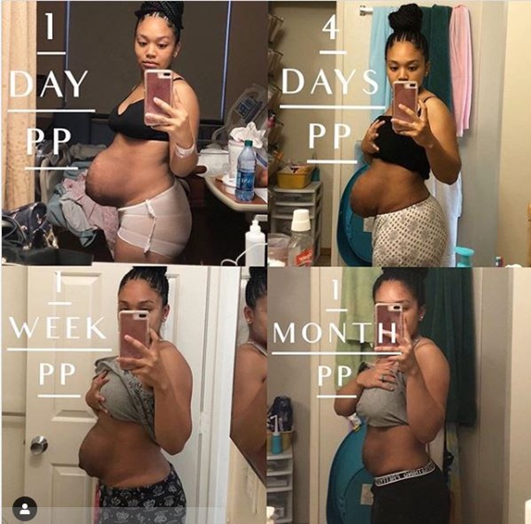 Bà mẹ dũng cảm phơi bày vòng 2 trần trụi sau khi sinh: Cứ như bầu đứa nữa, thâm rạn đến đáng sợ-2