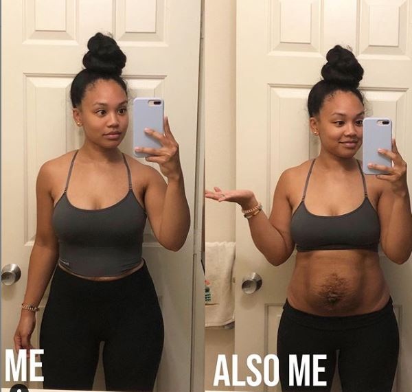 Bà mẹ dũng cảm phơi bày vòng 2 trần trụi sau khi sinh: Cứ như bầu đứa nữa, thâm rạn đến đáng sợ-3