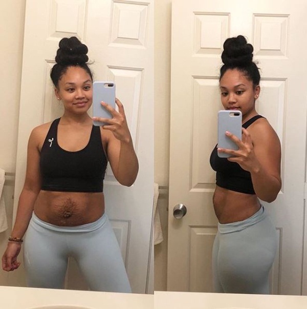 Bà mẹ dũng cảm phơi bày vòng 2 trần trụi sau khi sinh: Cứ như bầu đứa nữa, thâm rạn đến đáng sợ-4