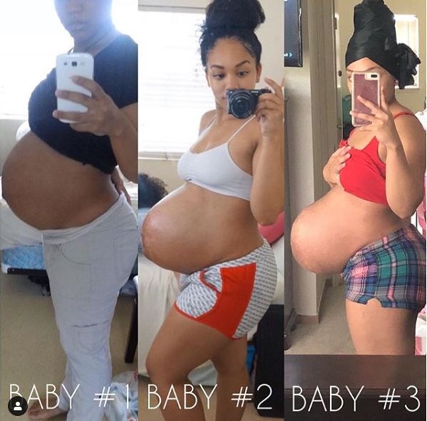 Bà mẹ dũng cảm phơi bày vòng 2 trần trụi sau khi sinh: Cứ như bầu đứa nữa, thâm rạn đến đáng sợ-5